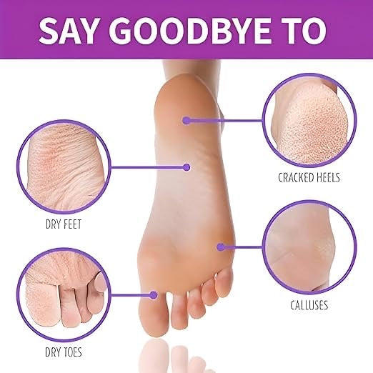Foot Peel Mask For Dead Skin Removal Dry Cracked Callus Remover Hydrating Sock Deeply
Moisturizes Dry & Dull Skin Reduces Pigmentation- Goat
Milk Essence