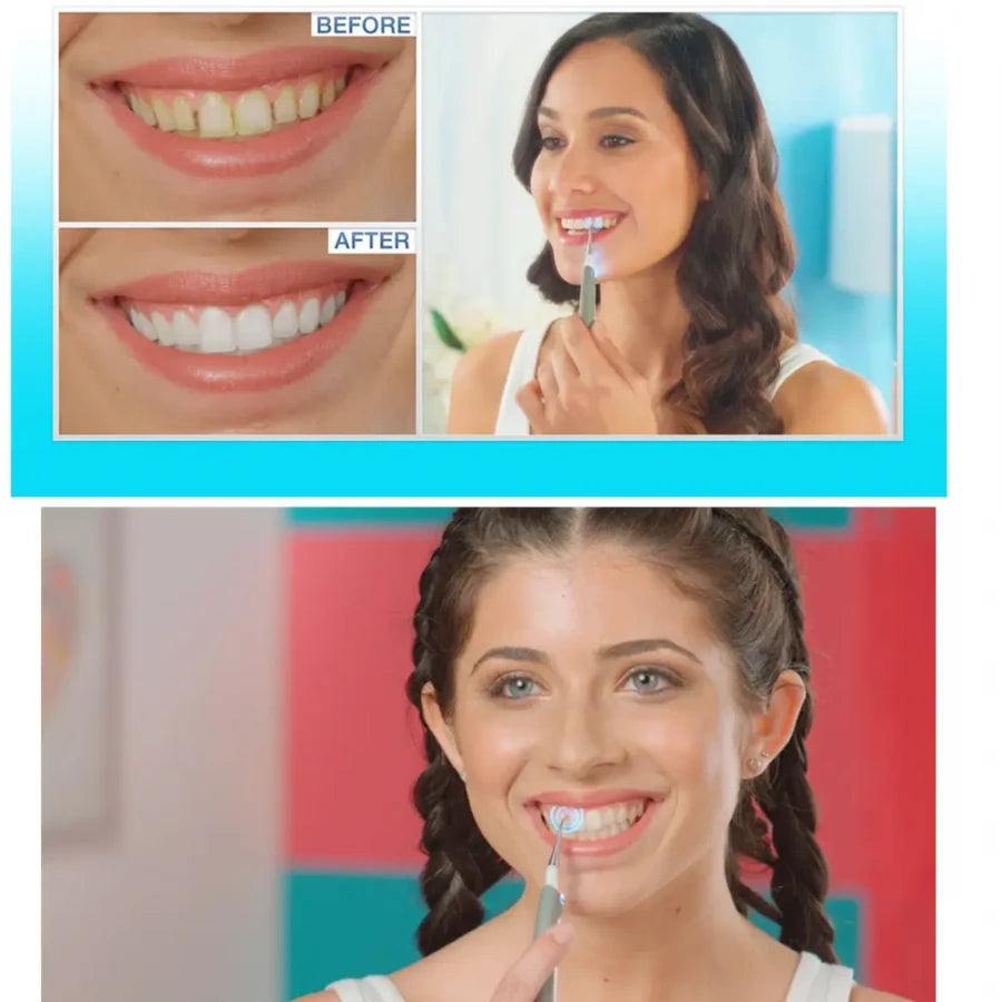 Ultrasonic Electric Dental Cleaner with LED Light – Professional Plaque & Tartar Remover