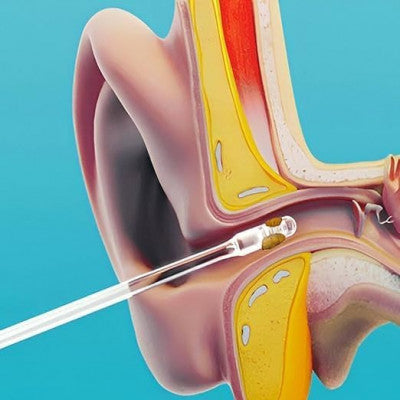 SafeTouch Adhesive Ear Wax Cleaner Stick – Soft & Reusable Ear Cleaning Tool (Pack of 24)