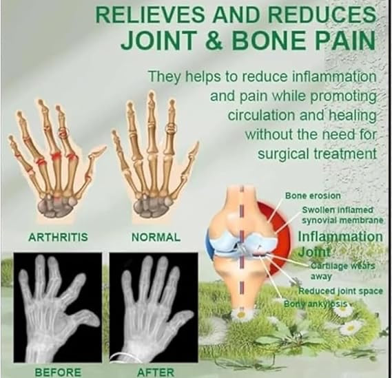 Bee Venom Pain Relief Cream | Bee Venom Joint and Bone Therapy Cream | (100g)