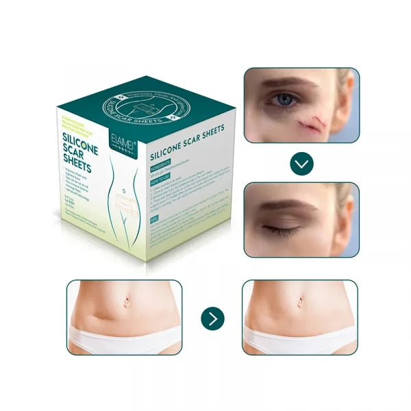 Silicone Scar Sheets Strips – Reusable Gel Tape for Scar Reduction & Skin Healing