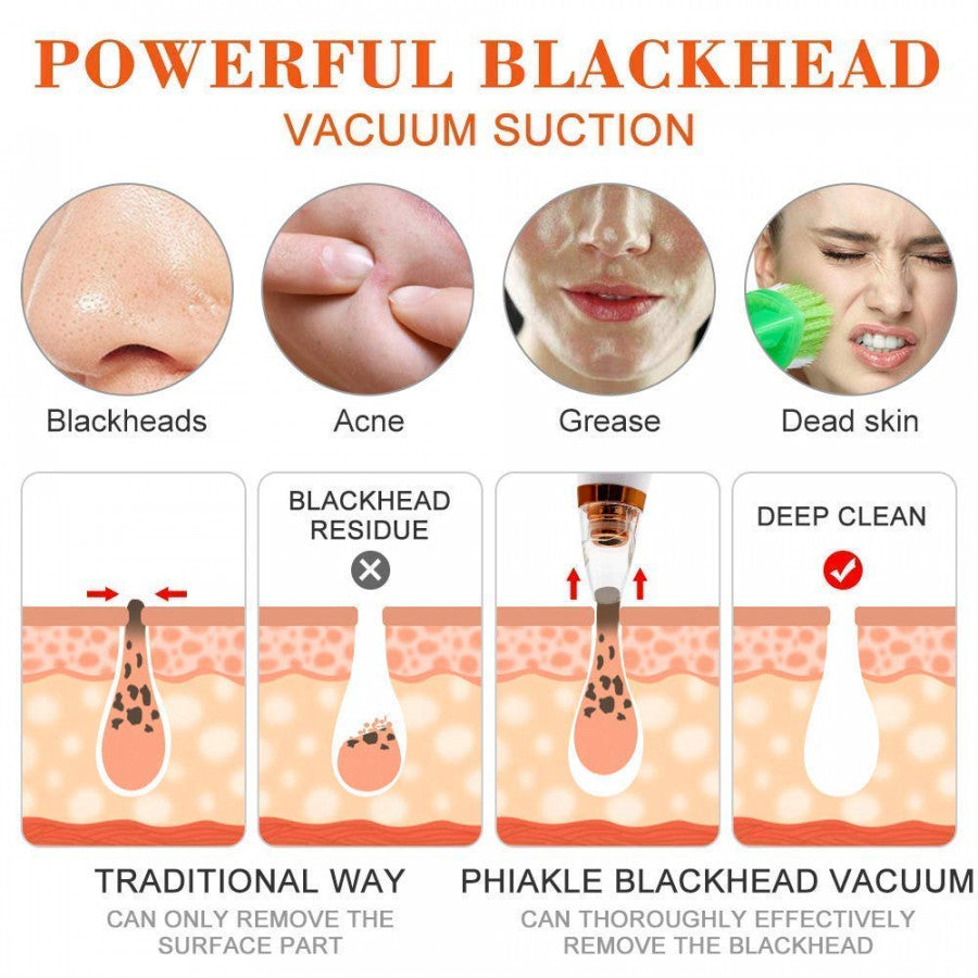 6-in-1 Multi-Function Blackhead Remover Vacuum & Pore Cleaner