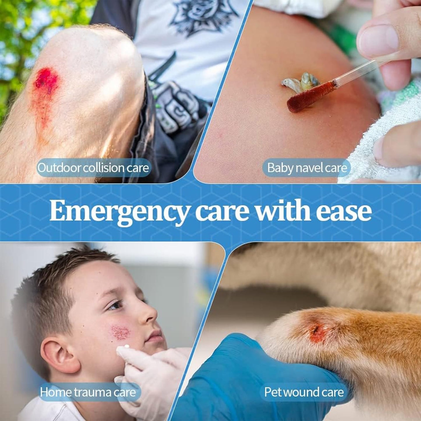 50 Pcs Cotton Iodine Swab Sticks – Pre-Filled Antiseptic Cleaning Swabs