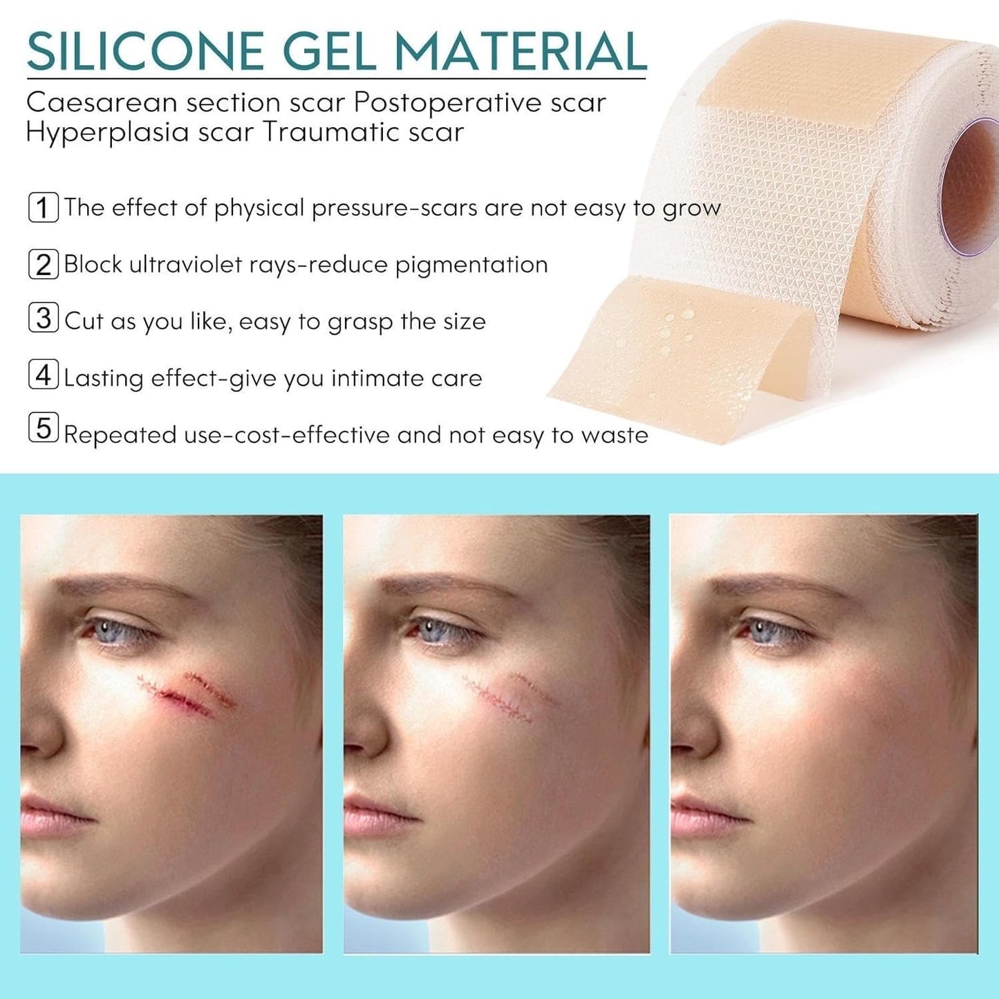 Silicone Scar Sheets, Silicon gel sheets for Scars Transparent Medical Silicone Tape for Scar Removal