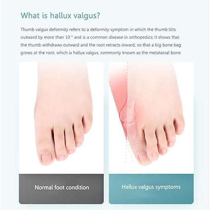 Toe straightener Bunion Corrector with Silicon Gel Pad for Women & Men, Hallux Valgus Adjustable Bunion Splint with toe fracture support for pain relief Day Night Support -