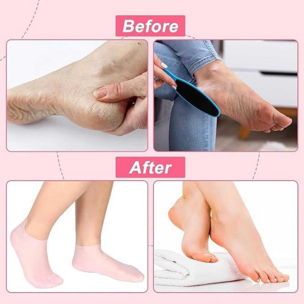🧦 Silicone Moisturizing Gel Socks – Reusable Hydrating Spa Socks with Vitamin-Enriched Gel