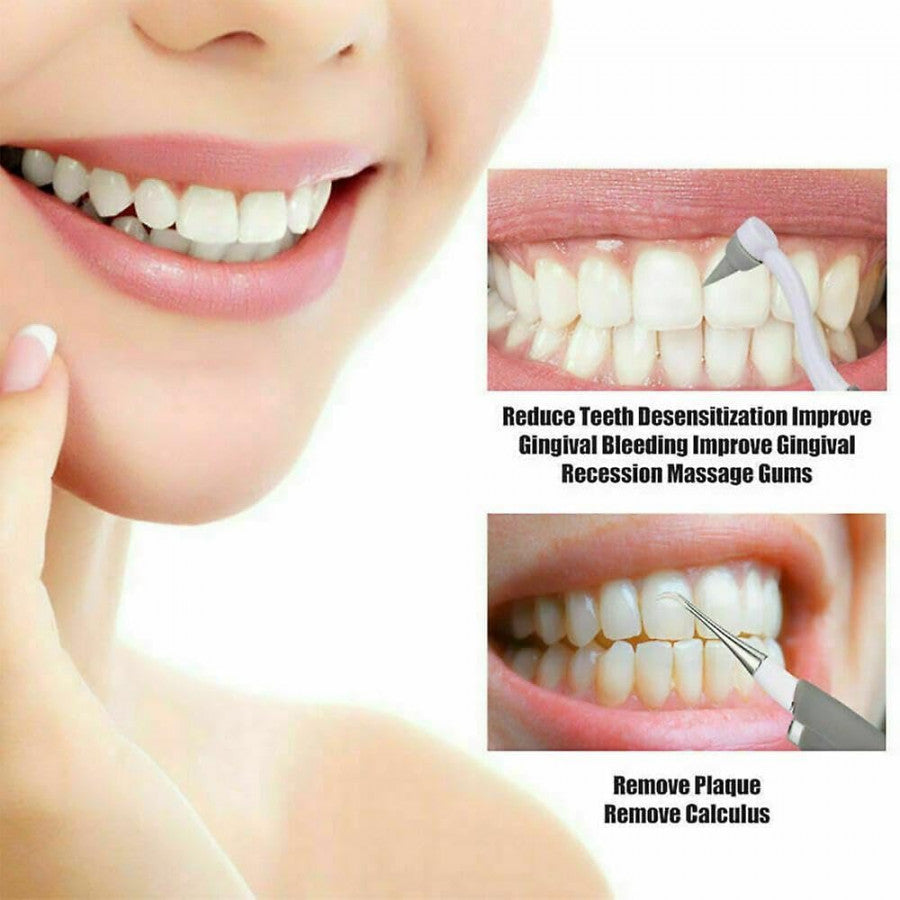 Ultrasonic Electric Dental Cleaner with LED Light – Professional Plaque & Tartar Remover