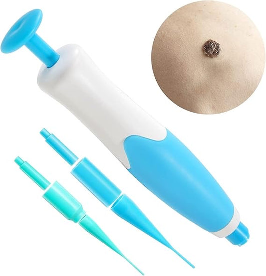 2-in-1 Skin Tag Remover Kit – Painless Auto Wart Removal Pen with Cleansing Wipes & Rubber Bands