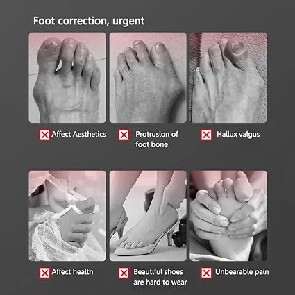 Toe straightener Bunion Corrector with Silicon Gel Pad for Women & Men, Hallux Valgus Adjustable Bunion Splint with toe fracture support for pain relief Day Night Support -