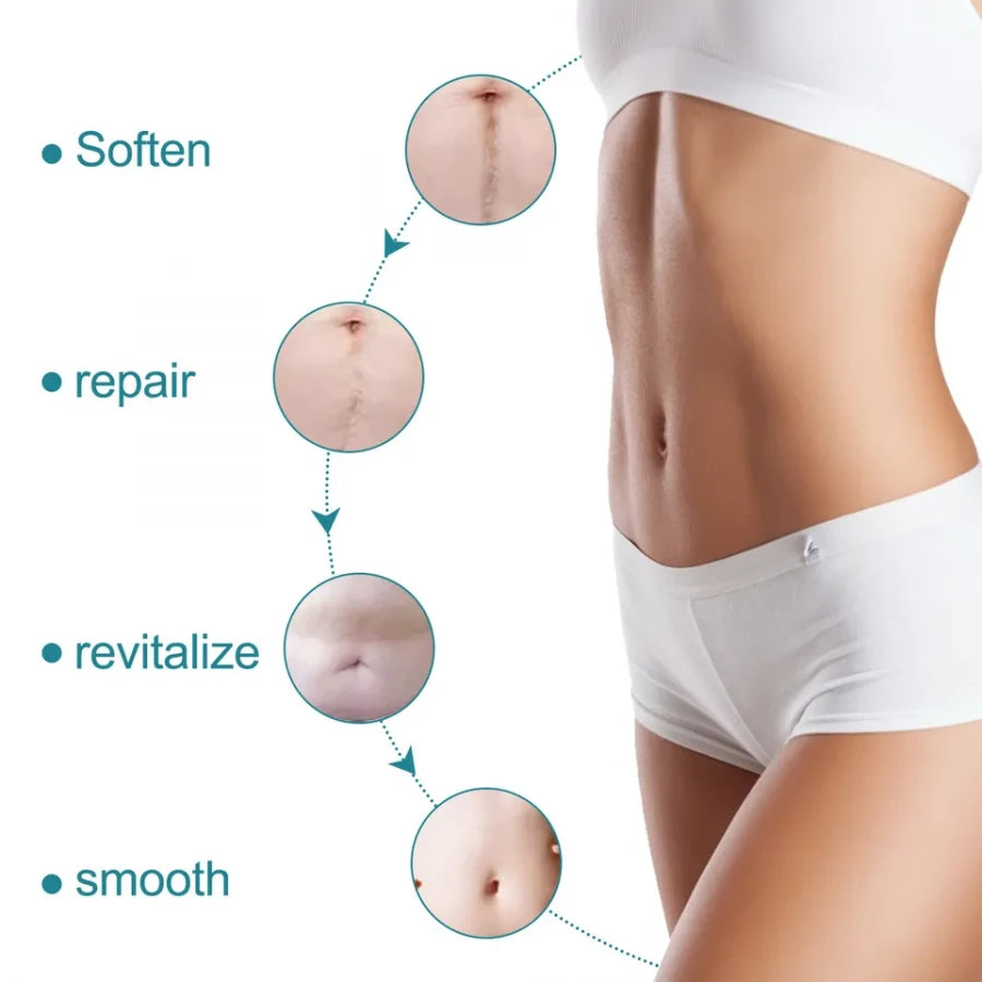 Silicone Scar Sheets Strips – Reusable Gel Tape for Scar Reduction & Skin Healing